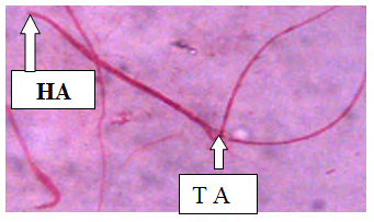 Figure 4: Plate II: Semen smears from Group 1 (1 ml of Normal saline for 18 days), Normal sperm cell morphology (Eosin stain at×400). Normal sperm as evidenced by Richard S [3].