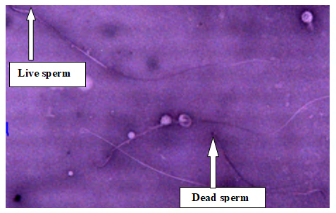 Figure 5: Plate III: Semen smears from Group 2 (100mg/ kg bwt of Ketoconazole Tablets for five days), Head (HA) and tail (TA) abnormalities (Eosin stain ×400), Head and Tail abnormalities as evidenced by Richard S [3].
