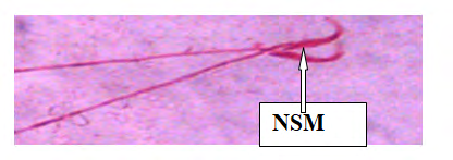 Figure 7: Plate V: Semen smears from Group 3 (500mg/ Kg bwt of ethanolic extract of _Sesamum indicum_ seeds for thirteen days and 100mg/Kg bwt of Ketoconazole Tablet for five days) viable sperm cells (VS) (Eousin-Negrosin × 400)
