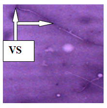 Figure 8: Plate VI: Semen smears from Group 4 (100mg/ Kg bwt of Ketoconazole Tablet for five days and 250mg/ Kg bwt of Ethanolic Extract of _Sesamum indicum_ seeds for thirteen days) Tail Abnormalities (TA) (Eousin- Negrosin × 400).