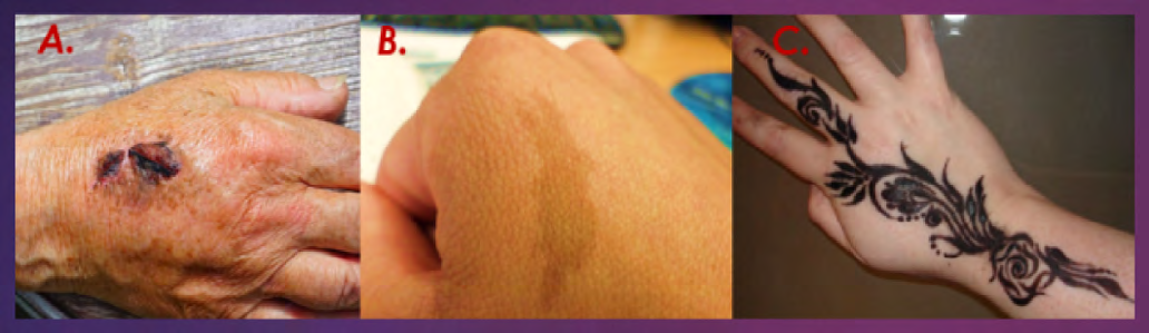 Figure 2: Soft biometric examples. Easily measurable physical characteristics that can change: A. Scars, B. Markings, C. Tattoos.