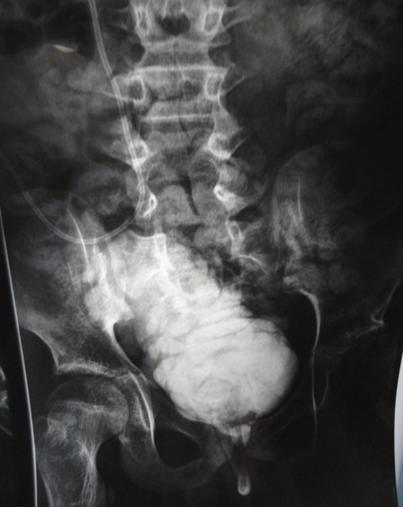 Figure 3: Urethrocytogram.