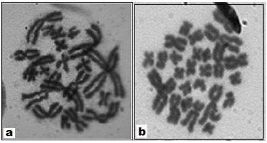 Figure 3: a-j: NOR detection by Silver staining and HCl- Trypsin digestion method (Individual chromosomes are arranged from different photographic plates showing less extended NOR and highly extended NOR) a = Silver stained NOR in _Bufo melanostictus; b_ = HCl_-_Trypsin treated Giemsa stained NOR in _B. himalayanus_. c = HCl -Trypsin treated Giemsa stained NOR in _B. stomaticus_ (male) with one NOR. d = HCl – Trypsin treated Giemsa stained NOR in _B. stomaticus_ (female) with two NOR. e, f = HCl_-_Trypsin treated Giemsa stained NOR in _B. melanostictus_ . NOR is less extended to highly extended state. g, h, i, j = Silver stained NOR in _B. melanostictus_ . NOR is less extended to highly extended state ( (Modified after Banerjee,1986; Banerjee and Chakrabarti, 1986; 1987).