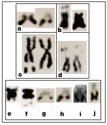 Figure 4: a-g: a = Silver stained cells in _Bufo melanostictus_ _(B.m_). Variations in number of the Ag-stained nucleoli in interphase cells (arrowed); b = Silver stained metaphase with two NOR bearing chromosomes in _B.m_. Interestingly, NOR is extended (large arrow) in one chromosome of the homologue but other is dotted (small arrow). NOR is exposed (arrowed) by HCl-trypsin digestion method in _Rana tigrina_ (c); _R. cyanophlyctis_ (d); _R. erythrea_ (e); _R._ _limnocharis limnocharis_ (f) and _Rhacophorus_ _maculatus_ (g) (Modified after Banerjee, 1986; Banerjee and Chakrabarti, 1986)