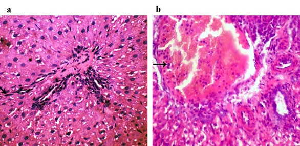 Figure 2: Shows (a) Liver of lactating dams treated with the combined doses (1/20 LD50 of COC and 1/20 LD50 of CFP) orally from 0th - 21th days postpartum showing fibroblastic proliferation extended from portal area (arrow) (HE, 400x). (b) Liver of suckling pups of treated dams with the combined doses (1/20 LD50 of COC and 1/20 LD50 of CFP) orally from 0th - 21th days postpartum showing congestion of portal vein and margination of leukocytes (arrow) (HE, 400x).