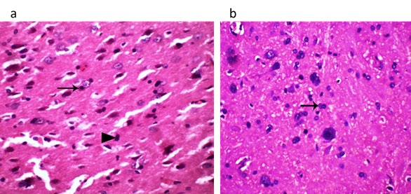 Figure 3: Shows (a) Brain of lactating dams treated with the combined doses (1/20 LD50 of COC and 1/20 LD50 of CFP) orally from 0th - 21th day’s postpartum showing satellitosis (arrow) and proliferation of astrocytes in brain parenchyma (astrocytosis) (arrow head) (HE, 400x). (b) Brain of suckling pups of treated dams with the combined doses (1/20 LD50 of COC and 1/20 LD50 of CFP) orally from 0th - 21th days postpartum showing astrocytosis (arrow) and edema of neuropil (HE, 400x).