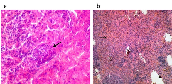 Figure 5: (a) Spleen of lactating dams treated with the combined doses (1/20 LD50 of COC and 1/20 LD50 of CFP) orally from 0th - 21th days postpartum showing lymphoid depletion in the splenic tissue (arrow) (HE, 400x).(b) Spleen of suckling pups of treated dams with the combined doses (1/20 LD50 of COC and 1/20 LD50 of CFP) orally from 0th - 21th days postpartum showing lymphoid depletion showing congestion of the splenic sinusoids (arrow) and marked lymphoid depletion (arrow) (HE, 100x).
