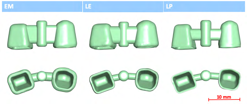Figure 1: The ceramic materials to be tested are (a) lithium disilicate - Ivoclar Vivadent® IPS e.max® CAD (Ivoclar Vivadent Inc., Amherst, NY) (EM), (b) zirconia with improved translucency with UV fluorescence-3MTM LavaTM Esthetic Fluorescent Full-Contour Zirconia Disc (3M, St. Paul, MN) (LE), and (c) zirconia chemically treated to ‘layer’ additional shading chemicals as a part of post milling process-3MTM LavaTM Plus High Translucency Zirconia Disc shaded with Lava Plus Dyeing Liquid (3M, St. Paul, MN) (LP). Wall thickness of the crowns were 1.2mm (EM), 0.8mm (LE), or 0.5mm (LP) with connector cross-sectional areas of 16mm2 (EM), 12mm2 (LE), or 7mm2 (LP) as shown in Figure 2. EM (n=14) bridges were ground using Sirona CEREC® inLab® MC XL (Dentsply Sirona, Charlotte, NC). LE (n=15) and LP (n=12) bridges were milled on Sirona inLab® MC X5 (Dentsply Sirona, Charlotte, NC). All restorations were heat-treated based on the manufacturers’ instructions using an Ivoclar Vivadent Programat® EP5000G2 furnace for crystallization (Ivoclar Vivadent Inc., Amherst, NY) (EM) or 3M Lava Furnace 200 for final sintering (3M, St. Paul, MN) (LE, LP). Complete summary of sample descriptions are presented in Table 1. All restorations were cemented on tooth shaped abutments made from a composite material to simulate dentin. Force was applied to the bridge pontic using an Instron 5566® universal testing machine to determine fracture force. 2-tailed-t-tests (p<0.05) have been performed for all groups.