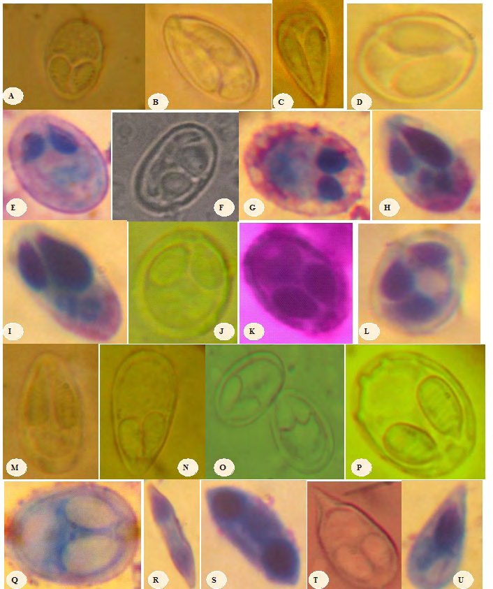 Figure 3: Spore micrographs of Myxosporeans found in fishes in MAPE dam, Adamawa-Cameroon.