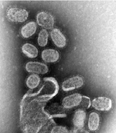Figure 1: Influenza virus magnified approximately 100,000 times, Specialty: Infectious disease. Symptoms: Fever, runny nose, sore throat, muscle and joint pain, headache, coughing, feeling tired, Usual onset: One to four days after exposure, Duration: 1 week, Causes: Influenza viruses. Prevention: Hand washing, influenza vaccine, surgical masks, Frequency: 3-5million severe cases per year. Deaths: Up to 650,000 respiratory deaths per year [1-3] (Table 1).