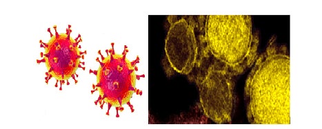 Figure 9: MERS virus, Middle-East Respiratory Syndrome coronavirus Virion, (Camel Flu) [214].