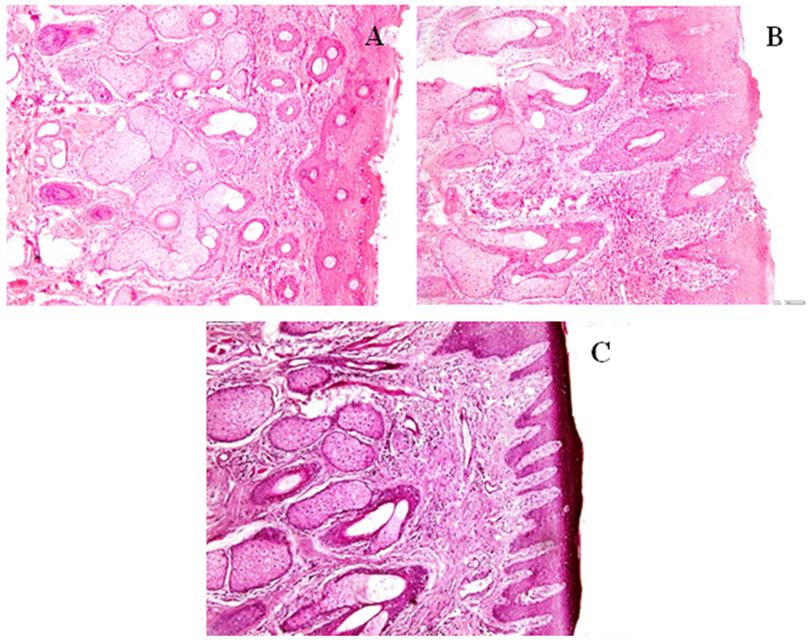 Figure 5: Photomicrographs of the Anterior Segments of Sheep Nasal Mucosa Treated with pH 6.4 PBS (negative control, A), Isopropyl alcohol (positive control, B), and CZ- Loaded Transferosomes (C) (100X).