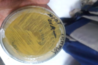 Figure 1: Culturing of _S. cerevisiae_ on YPD-Agar Plate.