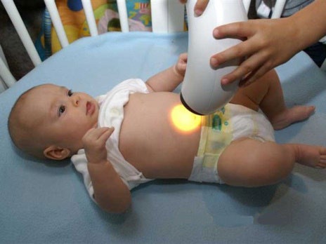 Figure 1: light Therapy (PVIP) performed by the “BIOPTRON-COMPACT” device-5cm.