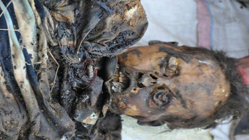 Figure 4: Facial features of the deceased body.