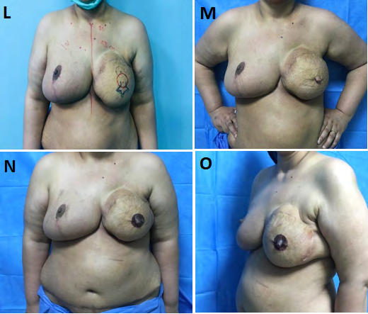 Figure 16