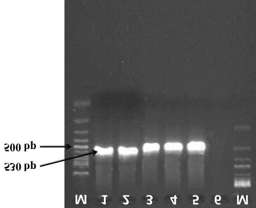 Figure 2: Electrophoresis result of specific PCR products of direct smear samples of Blastocystis hominis positive samples with STS primers in 1.5% agarose gel M: 100bp marker (column: 1 negative control, columns 2: positive control, columns 3 to 6: patients’ sample 600 bp).