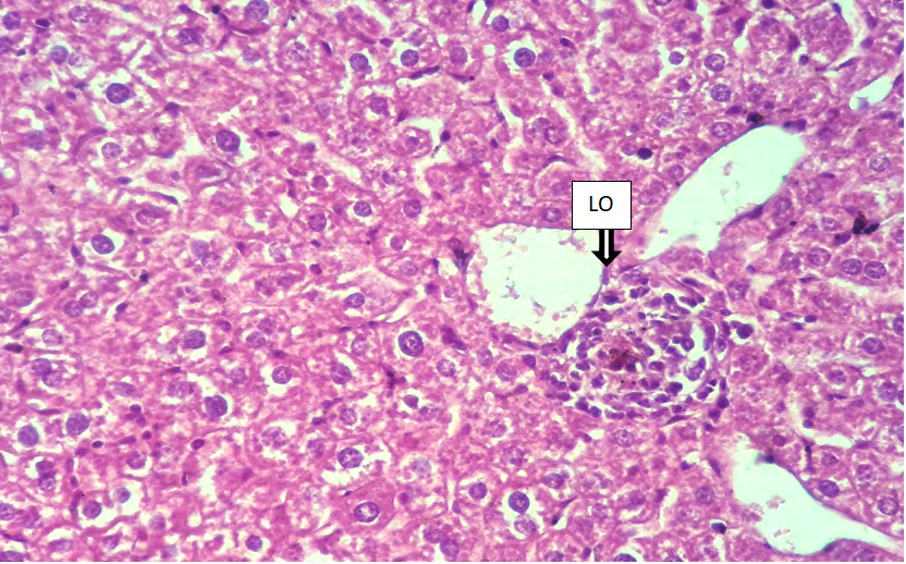 Figure 5: Cross histological section of the liver tissue from castrated male mice showing lobular inflammation (LO), (X400).
