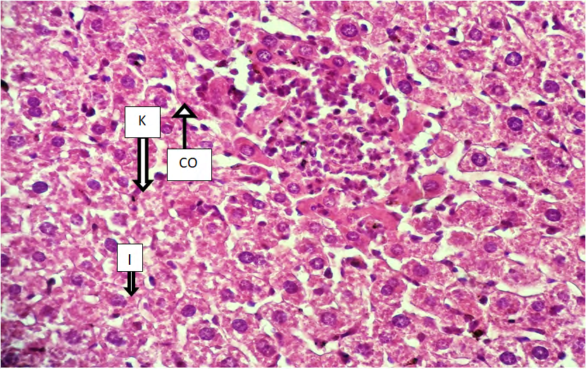 Figure 7: Cross histological section of liver tissue from castrated male mice showing Councilman Body (CO), Kupffer cell (K), Ito cell (I), (H&E, X 400)