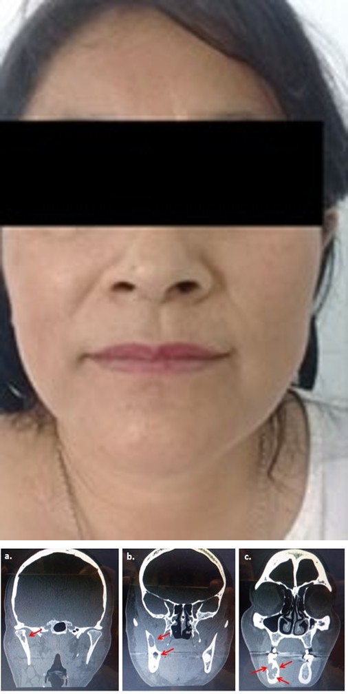 Figure 1: Clinical Photograph without clinical data of the lesion.
