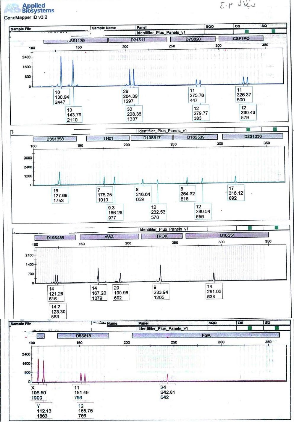 Figure 3: DNA profile from victim’s trouser stain.