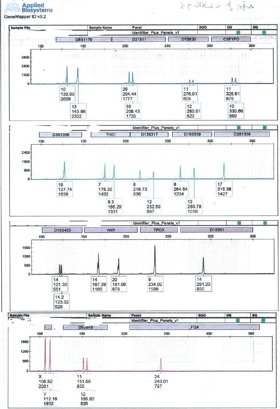 Figure 4: DNA profile from first suspect blood.
