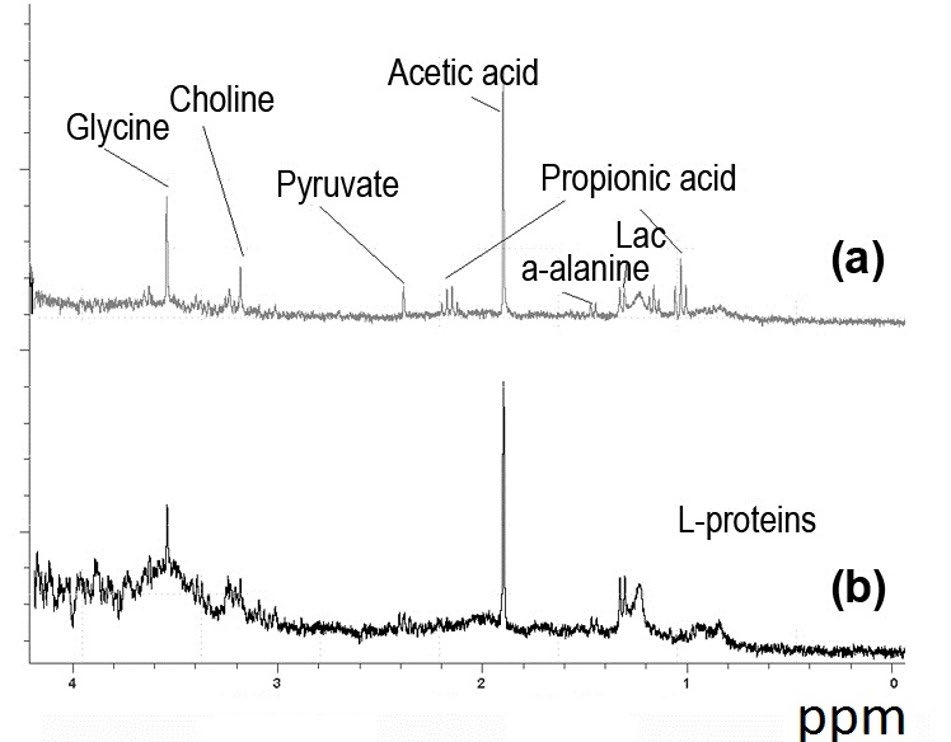 Figure 2: a) 1H NMR spectra of celomic fluid of intacted starfish (Asterina pectinifera); b) 1H NMR spectra of celomic fluid of starfish (A. pectinifera) after hypoxia.