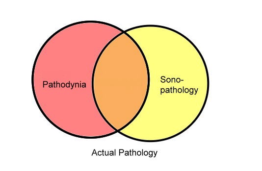 Figure 1: A Venn diagram showing the relations between actual pathology, sonopathology and pathodynia.
