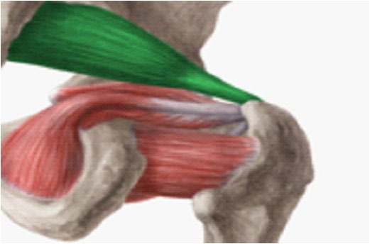 Figure 4: A posterior view of the greater trochanter showing the piriformis muscle in green and its tendon attaching to the superior trochanter.