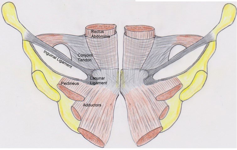 Figure 5: The anatomy of the attachments at the pelvis showing the major tendons and ligaments that contribute to athletic groin pain.