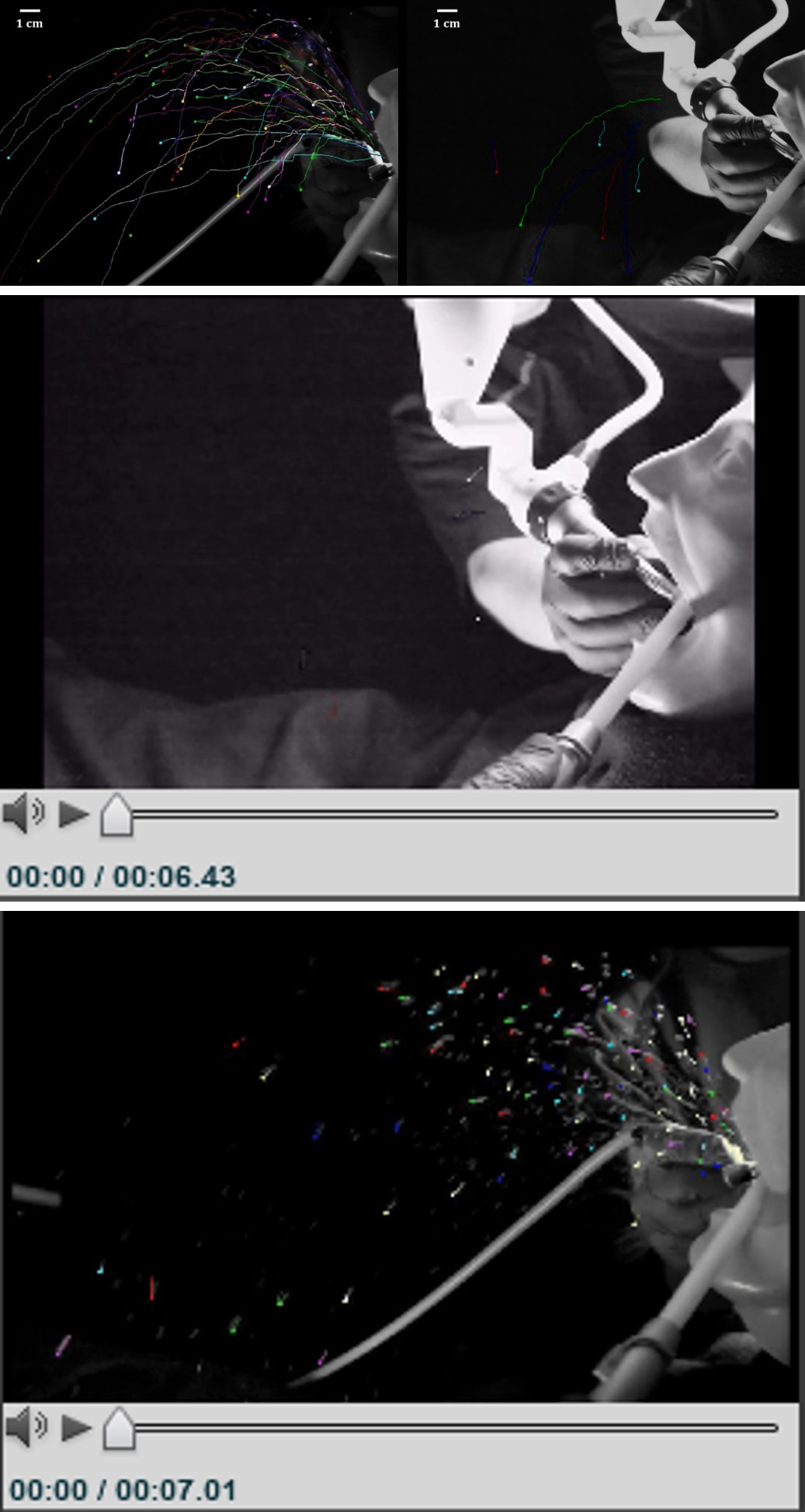 Figure 1: The manually tracked droplets are shown over the duration of 0.21 seconds to provide a visualization of the splatter from drill (A) and laser (B) on a human molar.