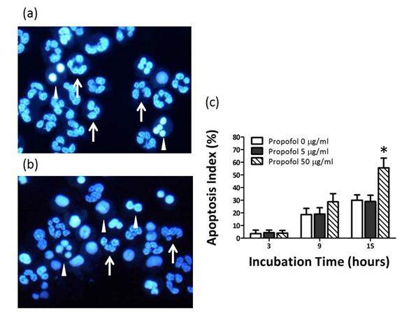Figure 1: Effects of incubation with propofol for 15 h on human neutrophil apoptosis determined by Hoechst 33342 staining. Neutrophils were treated with 0 (a) or 50 μg/ml, (b) Propofol. Representative images of cells stained with Hoechst 33342 are shown. Arrows, normal cells; arrowheads, apoptotic cells, (c) Dose-dependent effects of propofol on the apoptosis index. Data are expressed as means ± SD (_n_=8). *_P_< 0.01 _vs_. cells treated with 0 or 5 µg/ml propofol.