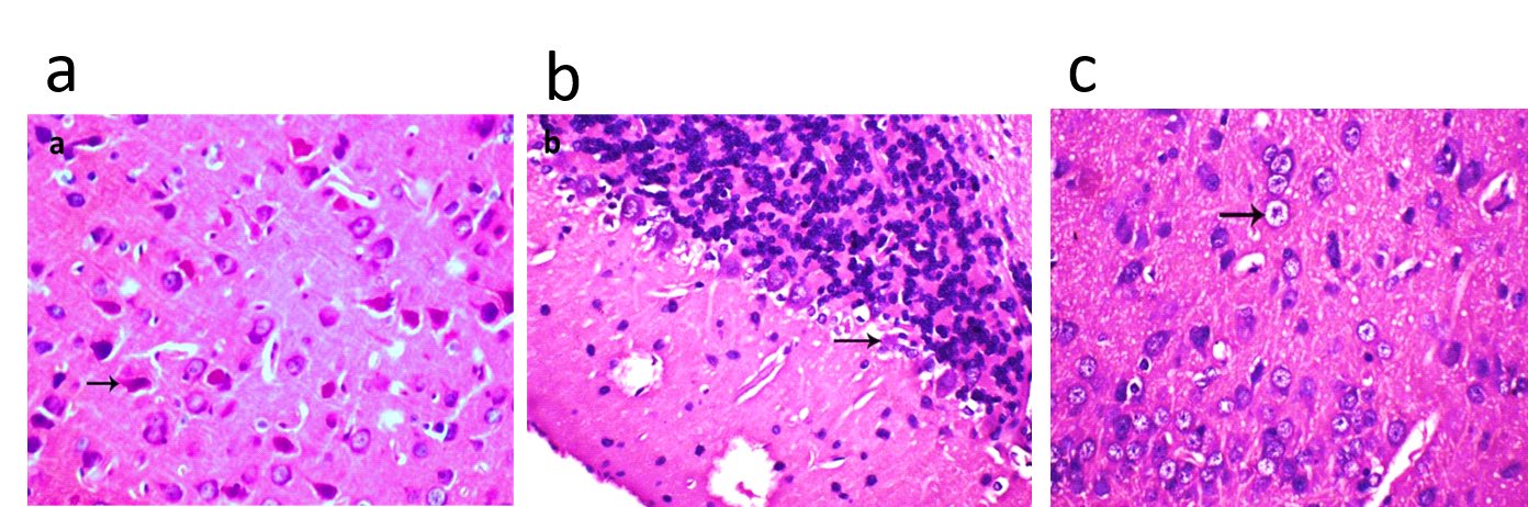Figure 2: The depicted figure shown (a) Brain of lactating dams treated with 1/10 LD50 of CFP orally from 0th - 21th days postpartum showing central chromatolysis and neuronal necrosis in the brain tissue (arrow) (HE, 400x) (b) Brain of lactating dams treated with 1/20 LD50 of CFP orally from 0th - 21th days postpartum showing degenerative changes of purkinje in cerebellum (arrow) (HE, 400x) (c) Brain of suckling pups of treated dams with 1/10 LD50 of CFP orally from 0th - 21th days postpartum showing cytotoxic edema of neurons (arrow) in (HE, 400x).
