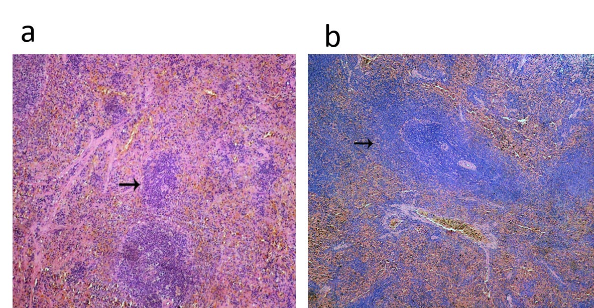 Figure 4: The depicted figure shown (a) Spleen of lactating dams treated with days postpartum showing severe depletion of the splenic lymphoid tissue (arrow) (HE, 100x). (b) Spleen of suckling pups of treated dams 1/10 LD50 of CFP orally from 0th - 21th days postpartum showing lymphoid depletion (arrow) (HE, 400x).