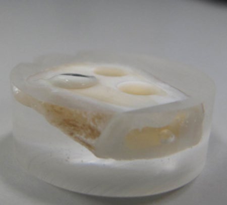 Figure 4: Excess resin cement (half-moon) cured after defined amount of time.
