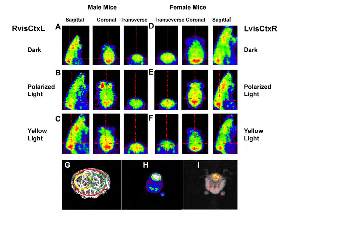Figure 2: The PET images (Figure 2 A-I), in sagittal, coronal and transverse views, from which the SUV data were derived are shown in male mice (Figure 2 A-C) and female mice (Figure 2 D-F). The VOI setup in mouse brain using a micro-CT image [49] is shown in transverse view (Figure 2 G), in PET (Figure 2 H) and PET/MRI (Figure 2 I) images. The image shows the arterial tree of the middle and posterior cerebral arteries including the cortical and ganglionic branches in the mouse brain. The figure illustrates the VOIs used for data analysis in relation to the brain vascular system, red: Ctx, black: visCtxL and green: visCtxR [with permission].