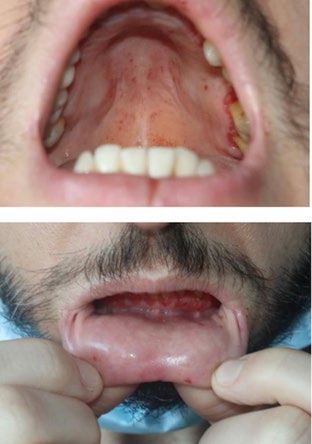 Figure 1: Swollen Lips.