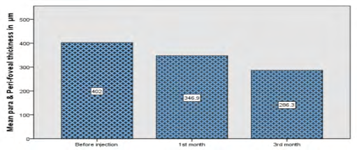 Figure 4: Diagrammatic representation between preoperative and postoperative para and Peri-foveal thickness.