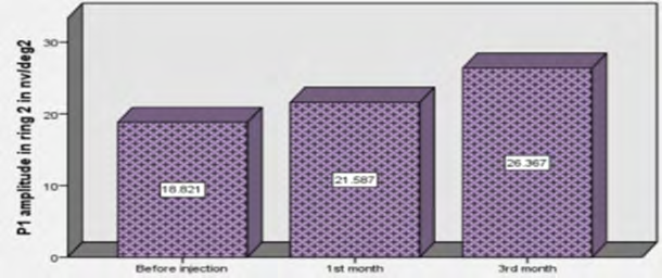 Figure 6: Diagrammatic representation between preoperative and postoperative P1 amplitude in ring 2.