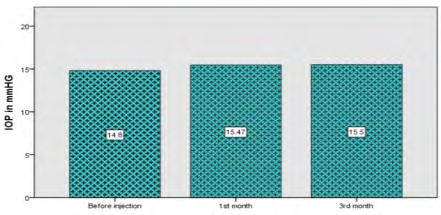 Figure 9: Diagrammatic representation between preoperative and postoperative IOP.