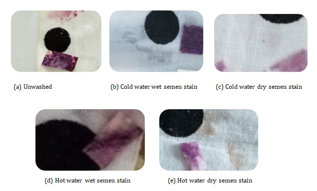 Figure 1: Relevant images after AP mapping of cotton fiber. a. Unwashed cotton control sample. b. The cotton sample was washed in cold while the stain was still wet. c. The cotton sample was washed in cold water after drying the stain. d. Cotton sample washed in hot water while the stain was still wet. e. The cotton sample was washed in hot water after drying the stain.