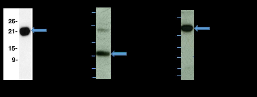 Figure 2: Immunoblot analyses of the plasma membrane fraction separated by SDS-PAGE on a 12% gel. 15µg of protein was loaded in each lane. Lane 1, 21kDa RAS, immunostained with anti- Pan-RAS; lane 2, 30kDa GRB2, immunostained with anti-GRB2; lane 3, 81kDa RAF- Kinase, immunostained with anti-RAF-Kinase.