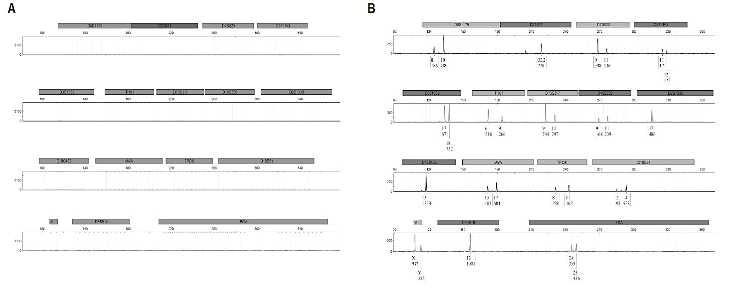Figure 1: Electropherograms relating to spinal cord (A) and femur treated with EDTA (B).