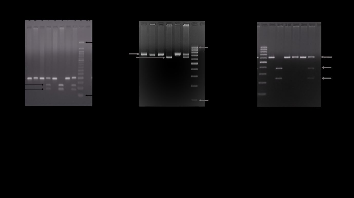 Figure 1: Representative gel images of (a) ERCC1 C118T (b) ERCC2 Lys751Gln and (c) XRCC1 Arg399Gln polymorphisms in CRC patients.