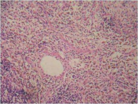 Figure 2: Group-A-Normal rats showing alpha and beta cells.