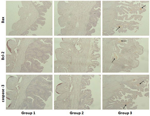 Figure 4: Localization of Bax, Bcl-2 and caspase-3 positive cells in uteri examined by immunohistochemistry (100X magnification). Gr. 1: control group, Gr. 2: pregnant female rats treated with BTE (50 mg /kg body weight/day, p.o.), Gr.3: pregnant female rats treated with BTE (100 mg / kg body weight/day, p.o.). Black arrow indicating the expression of respective antibodies in uteri of three different groups of mothers on day 20.