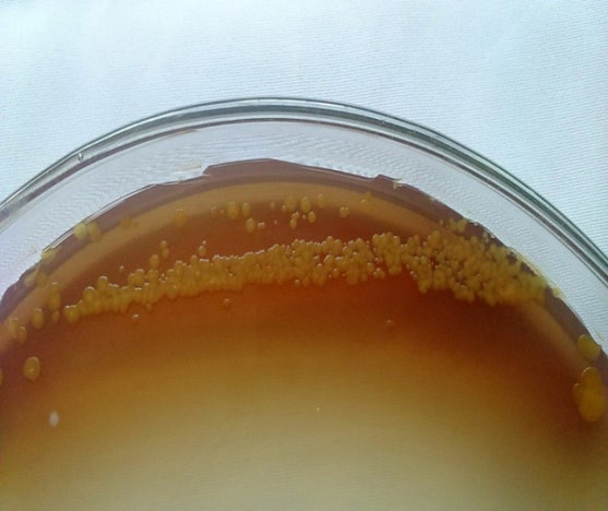Figure 1: Extracellular dark brown pigment produced by Xanthomonas campestris pv. vesicatoria in Nutrient Agar plates under the effect of aromatic oil’s vapour phase (aroma).