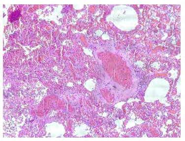 Figure 2: Personal Observation.