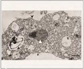 Figure 2: TEM. The cyst of Ent. moshkovskii. Scale bar: 1.0µm.