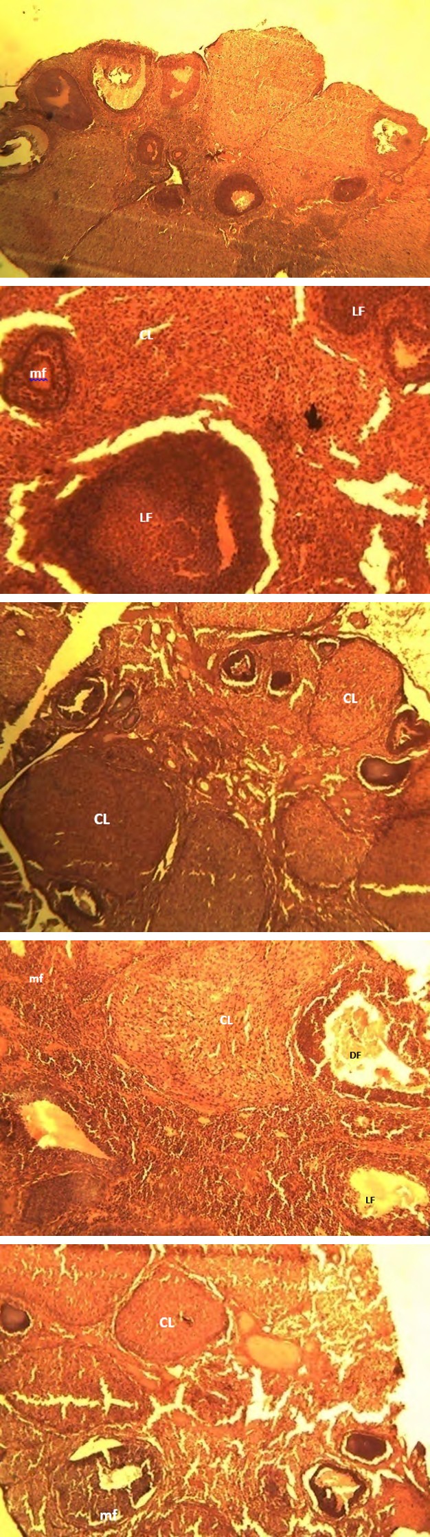 Figure 1: Histo-Micrograph of the Ovary for Boerhavia diffusa Extract Treated Rats. Key: CL: corpus luteum, df: degenerative follicles, MF: medium size (secondary) follicles, LF: Large (matured) follicular cells. Hematoxylin and Eosin x 400